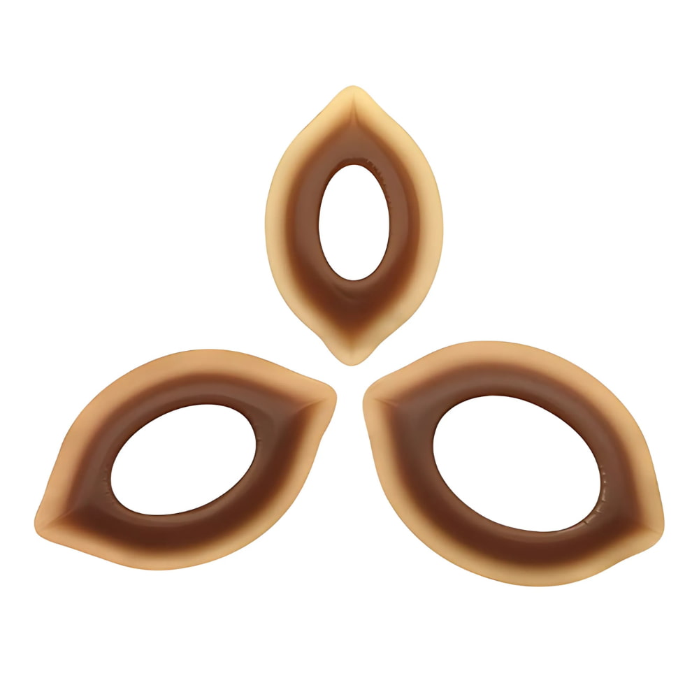 Flexible and moldable ostomy rings