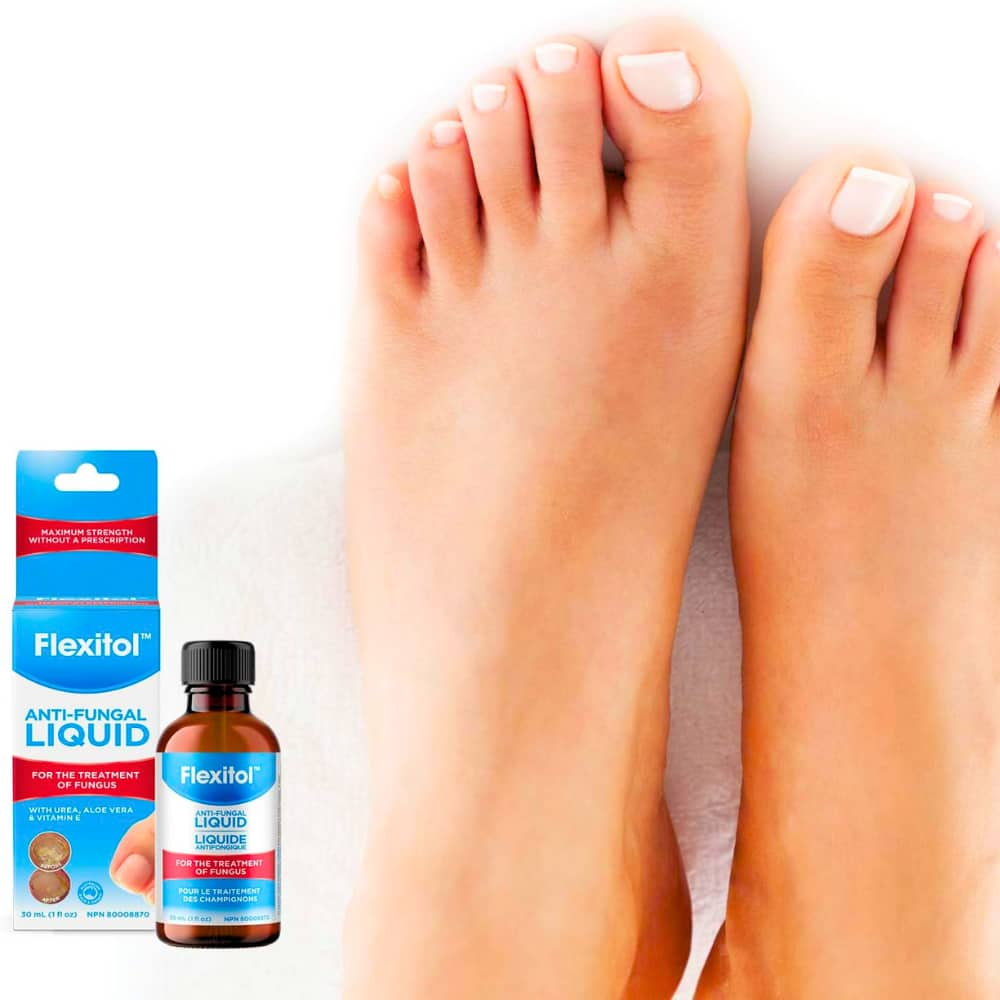 Flexitol Antifungal Liquid - 30ml