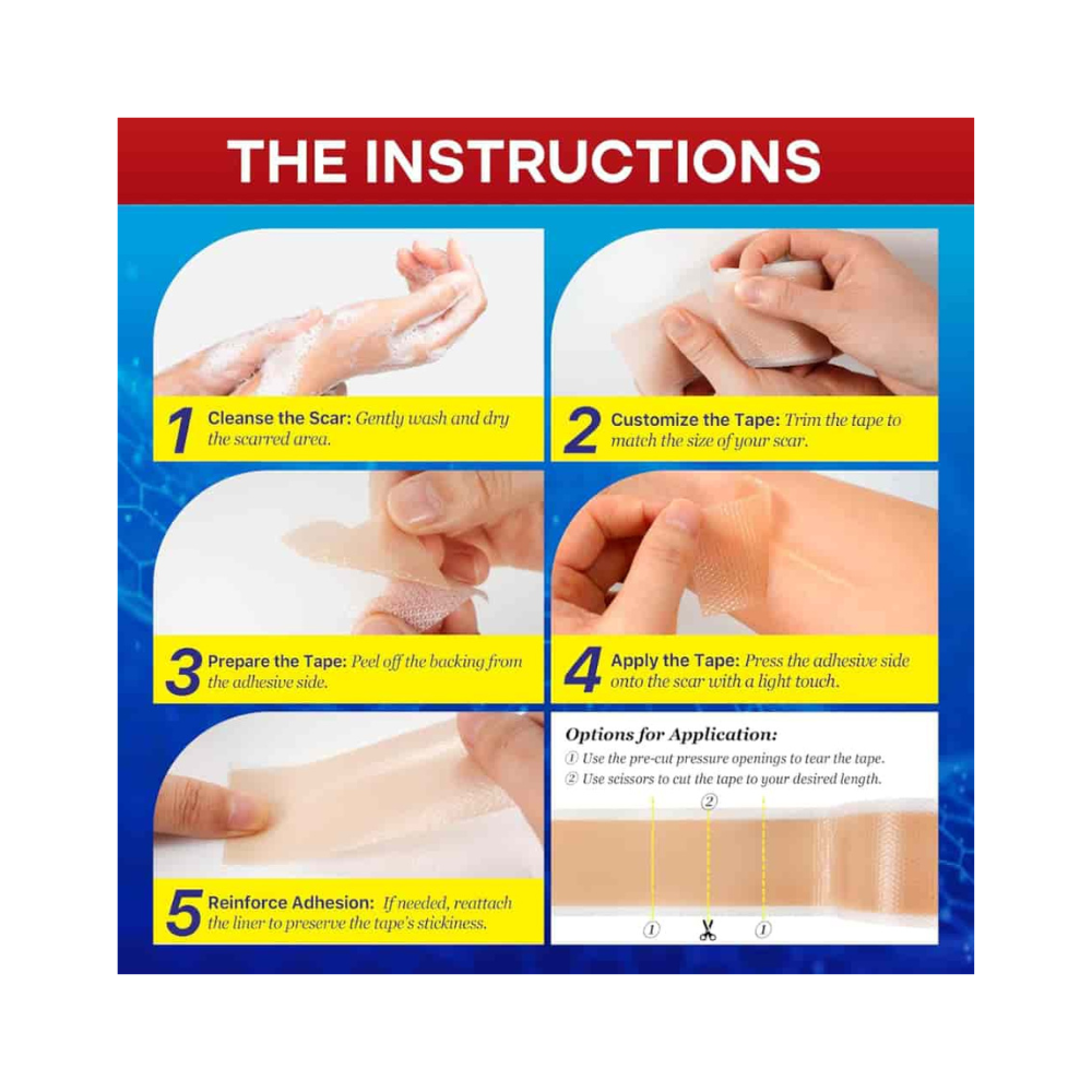 Medical Silicone Scar Tape Fade Scars Fast & Safely
