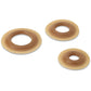 Prevent ostomy leakage with convex rings