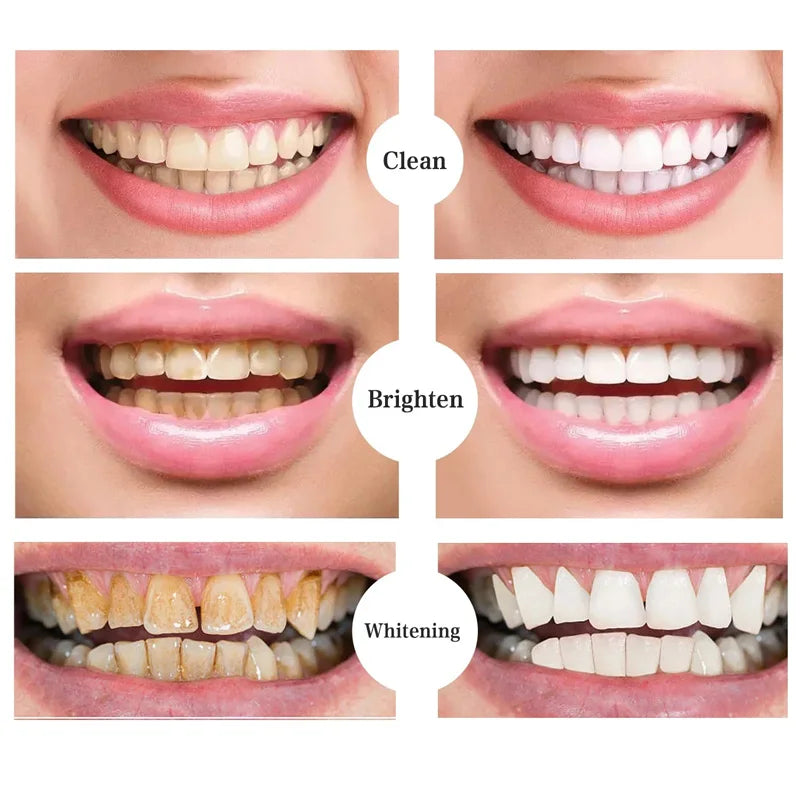 Teeth Whitening Products