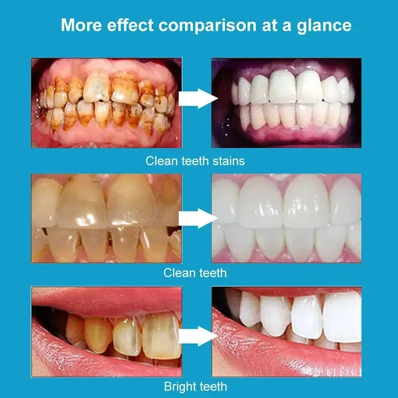 Teeth Whitening Products