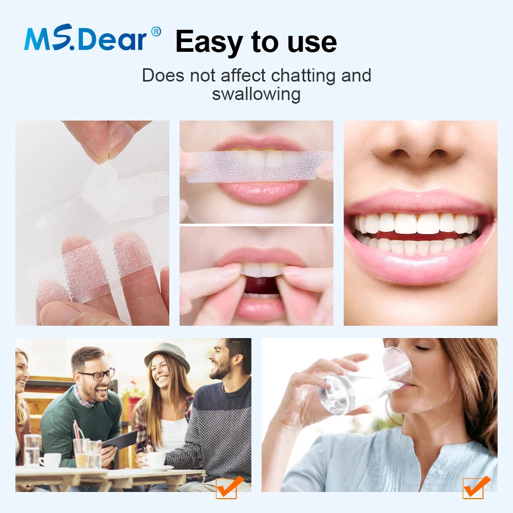 Teeth Whitening Strips