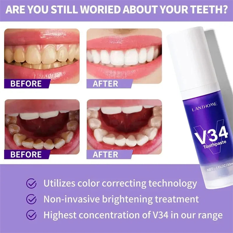 Teeth Whitening Products
