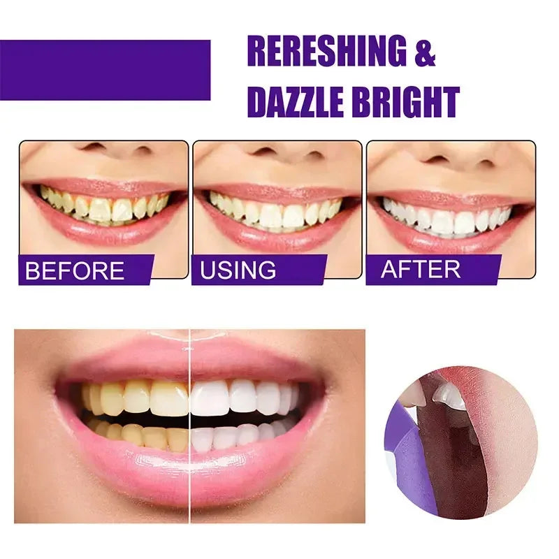 Teeth Whitening Products