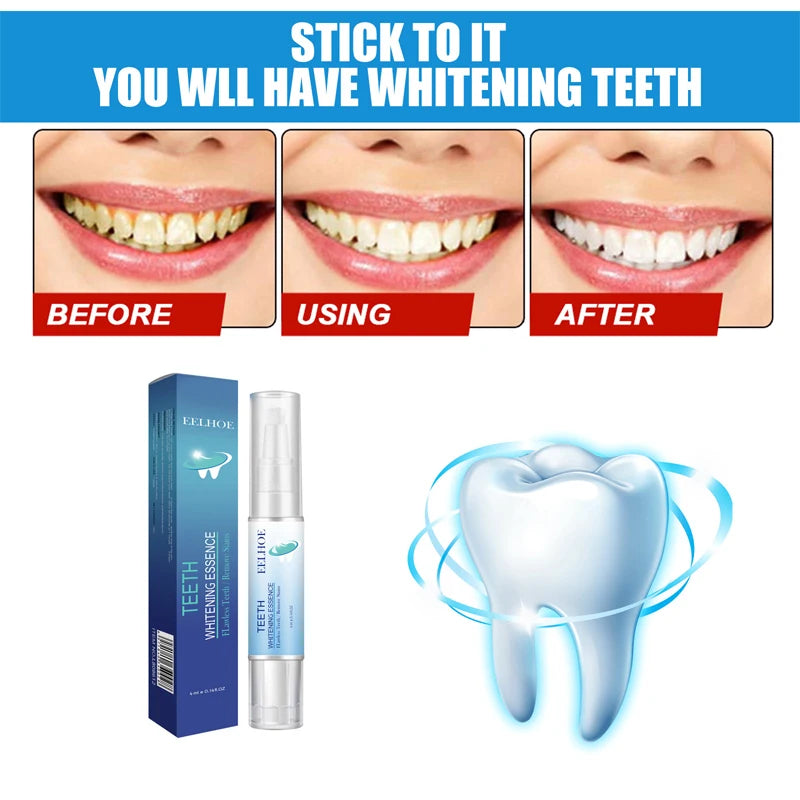 Teeth Whitening Products