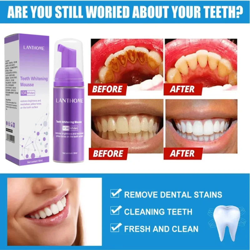 Teeth Whitening Products