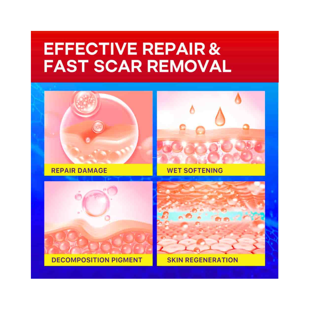 Scar Removal Tape Reduce Scars from Surgery & Burns