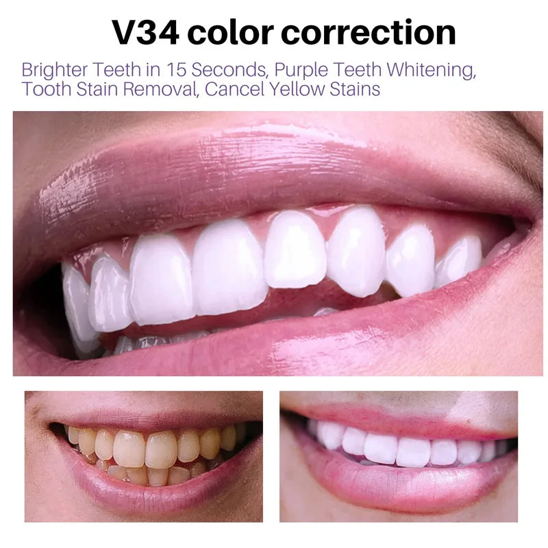 Teeth Whitening Products