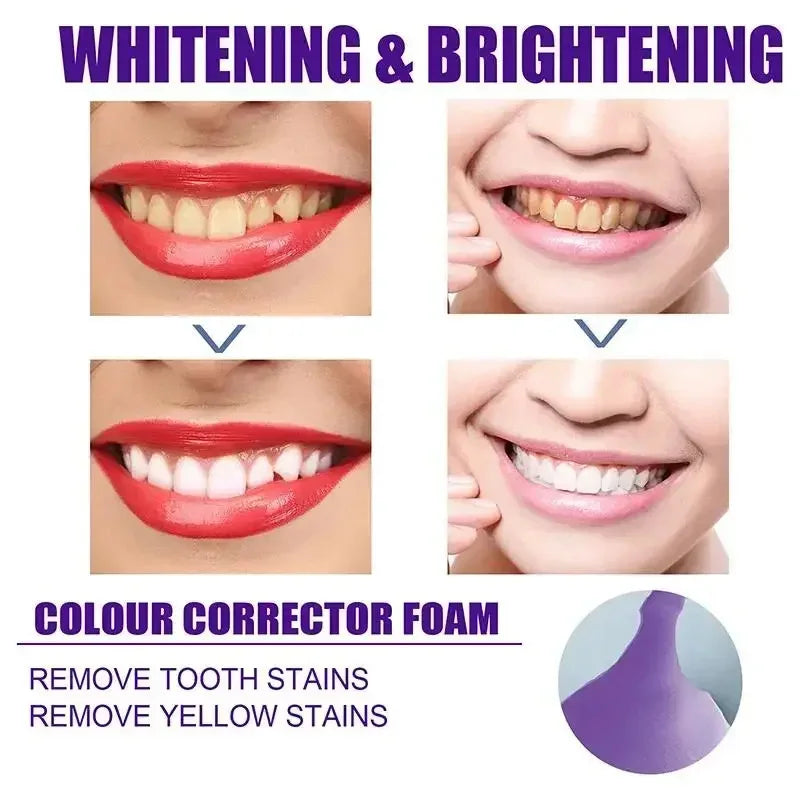 Teeth Whitening Products