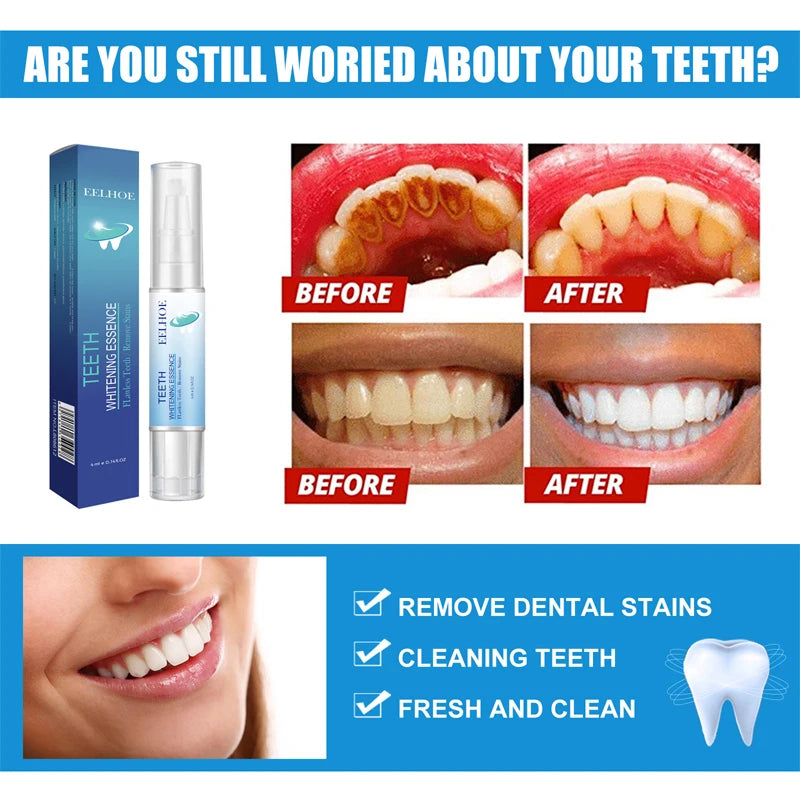 Teeth Whitening Products